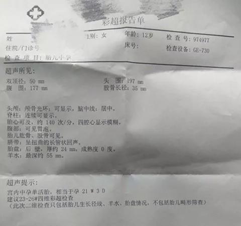 12岁小姑娘的内衣_别人家的女儿被捧成宝,这个12岁莆田女孩却要为爸爸洗内衣裤,还要...(2)